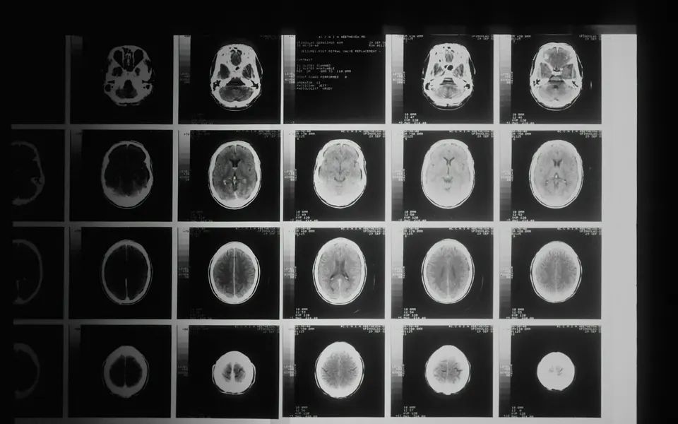 A grid of MRI brain scan images
